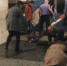 Выжившая в теракте: После взрыва у меня загорелись волосы - Сочи 24